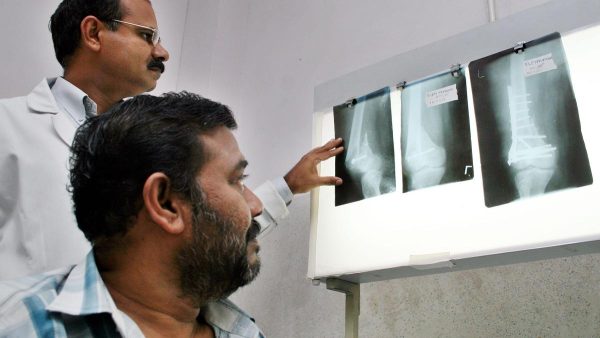 तनाव और कमजोर हड्डियाँ: आपके कशेरुकीय स्वास्थ्य पर दीर्घकालिक तनाव का छिपा प्रभाव