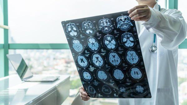 विश्व स्वास्थ्य सभा ने पहली बार स्ट्रोक को सार्वजनिक स्वास्थ्य प्राथमिकता घोषित किया