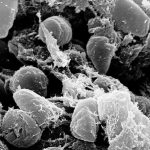 Diseases that changed history