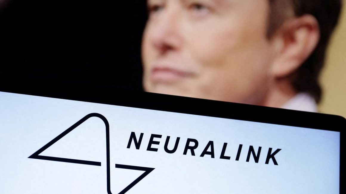 What makes the brain the most complicated object in the universe